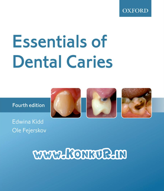 دانلود کتاب ملزومات پوسیدگی دندان ویرایش 4 چهارم (سال 2016)